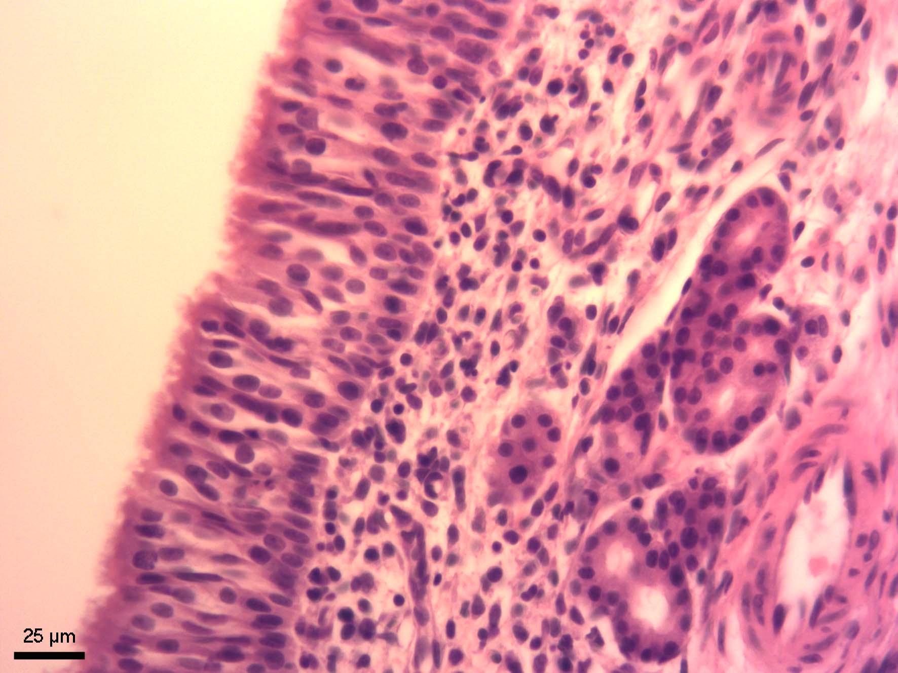 Čichový okrsek nosní sliznice (regio olfactoria tunicae mucosae nasi)