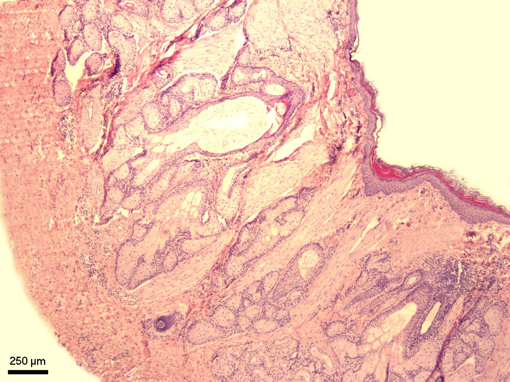 Meziprstní žláza (glandula sinus interdigitalis)