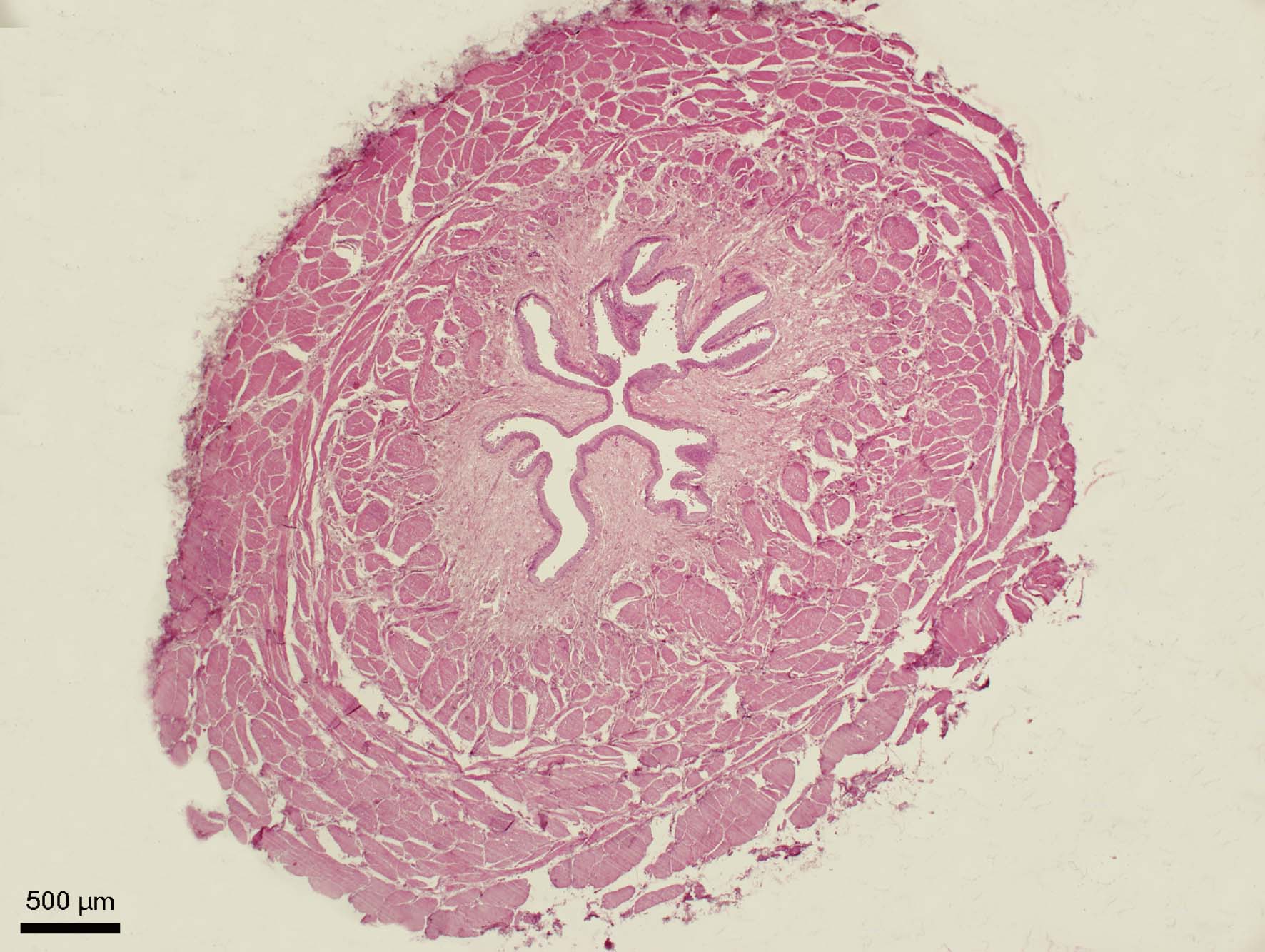 Močovod (ureter)