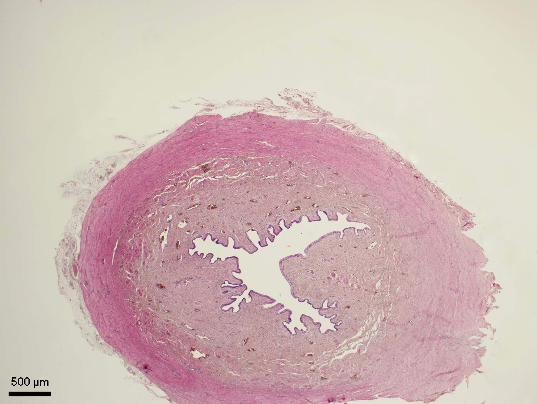 Močová trubice – samičí (urethra feminina)